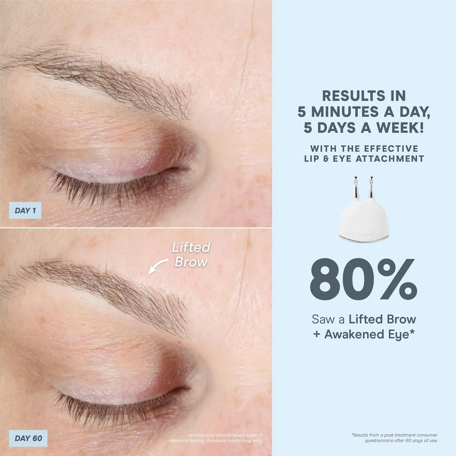 NuFACE TRINITY  Effective Lip & Eye Attachment for Microcurrent Facial Device - FDA Cleared At Home Eye Lift & Smile Lines Treatment to Tighten & Tone Hard-to-Reach Areas Around Mouth and Eyes