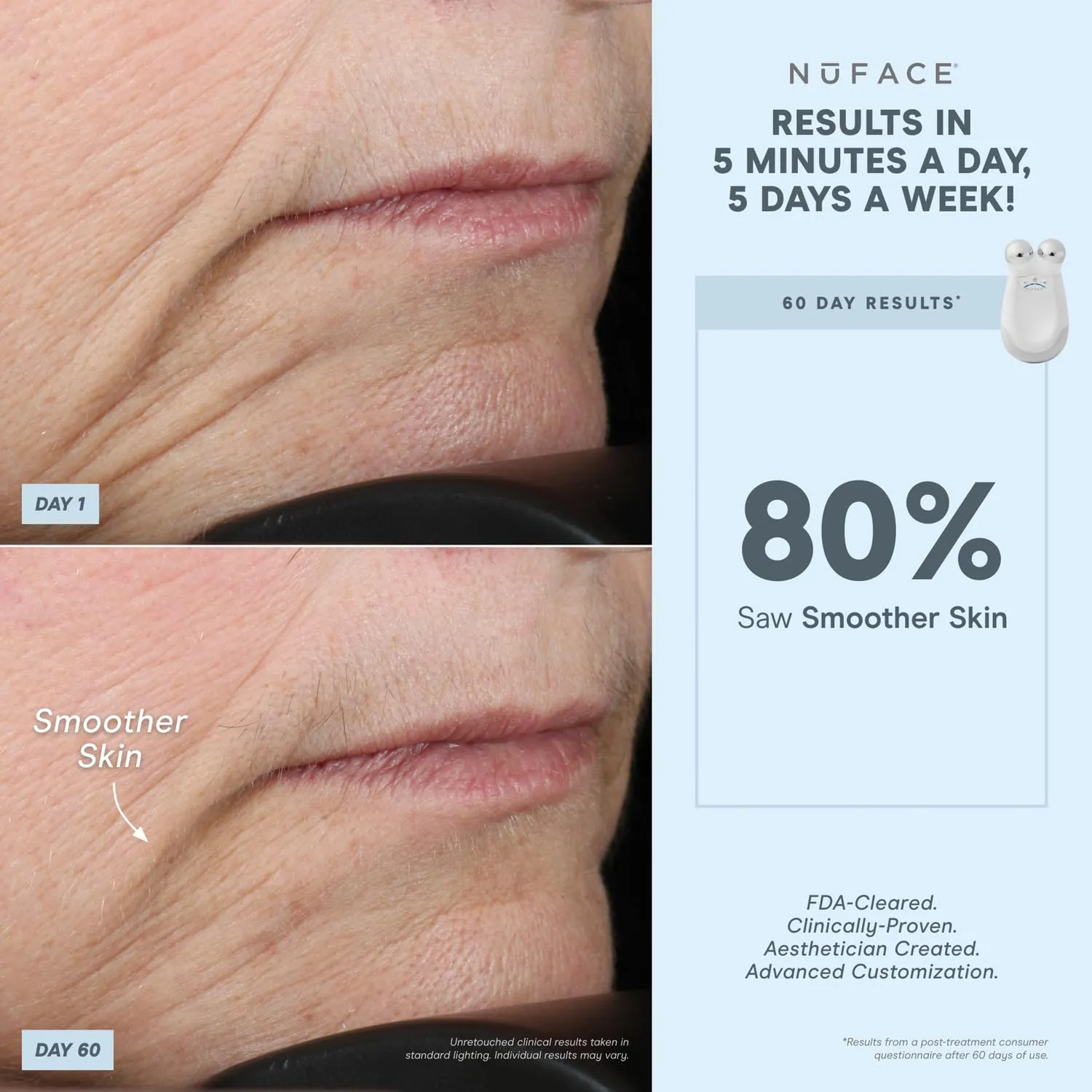 NuFACE Trinity FDA Cleared Microcurrent Facial Device & Wrinkle Reducer Attachment - Microcurrent Device with LED Red Light Attachment - Face Sculpting & Neck Tightening Device   Aqua Microcurrent Gel
