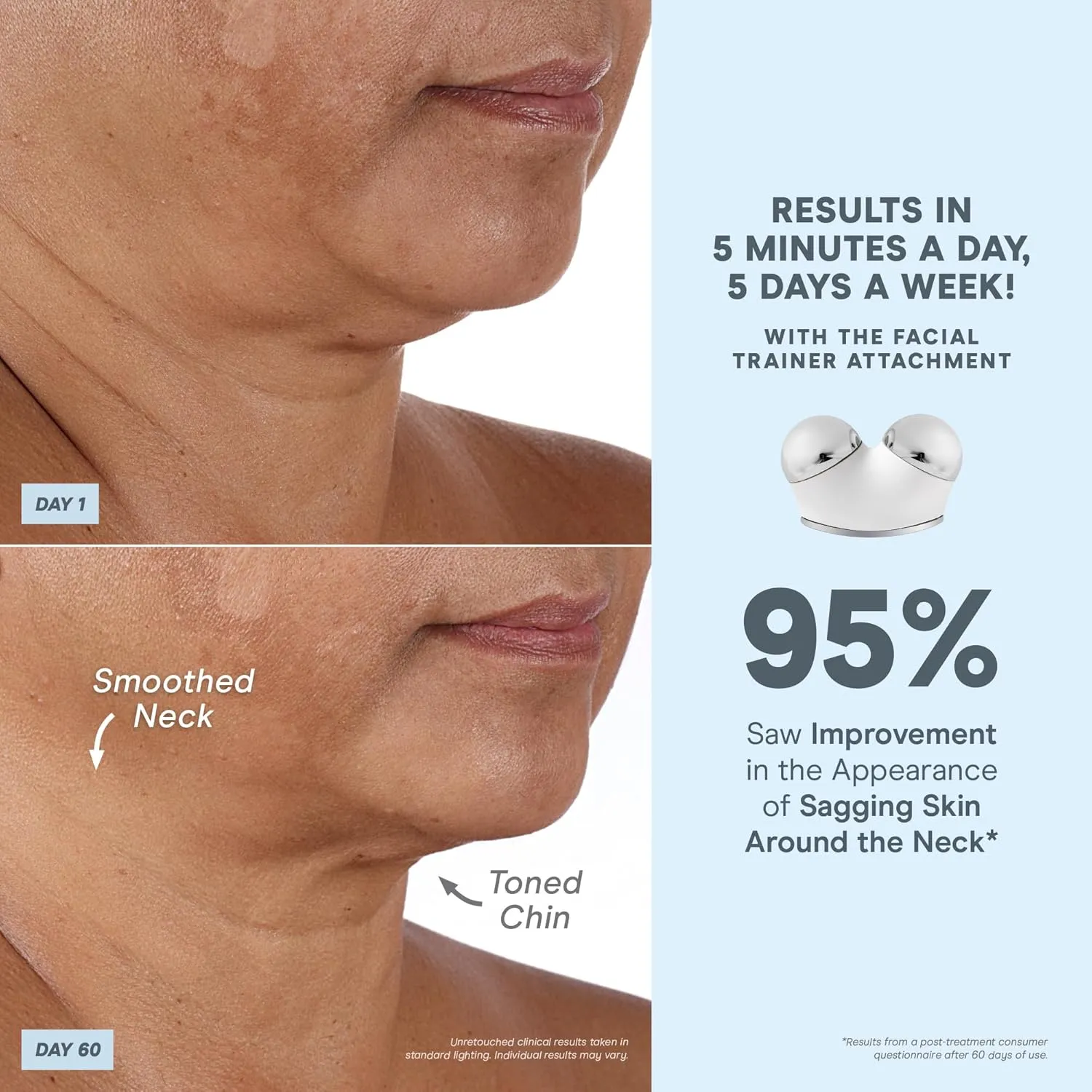 NuFACE TRINITY  Microcurrent Facial Device   Effective Lip & Eye Attachment - FDA Cleared Skin Tightening & Face Toning Device for Targeted Treatment   Microcurrent Gel Activator, Silk Crème & Brush
