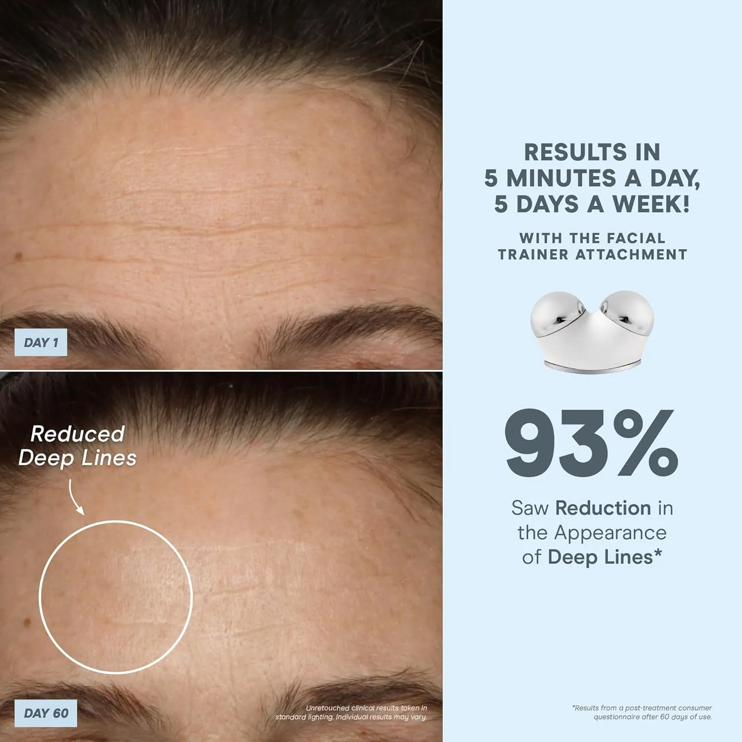 NuFACE TRINITY  Microcurrent Facial Device Kit - FDA Cleared Face Sculpting & Neck Tightening Device to Contour Cheeks & Brows   Microcurrent Gel Activator & Silk Creme